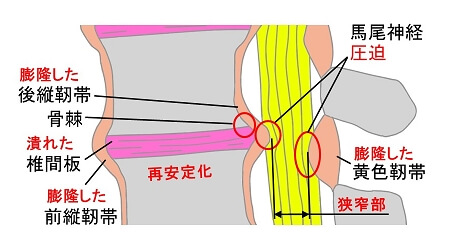 点灯プレワークアウト勃起不全