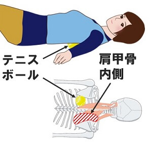 肩こりマッサージでは不十分な理由 名古屋市 ふるさわ指圧治療院