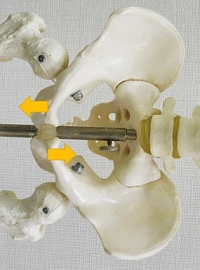 恥骨結合の上下方向の調整
