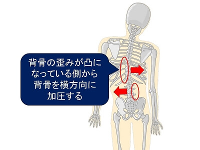 背骨の歪みを整える方法